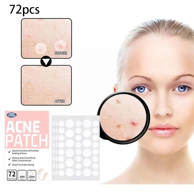 Akneplåster 72-pack | Köp ditt Pimple Patch hos pormaskar.nu